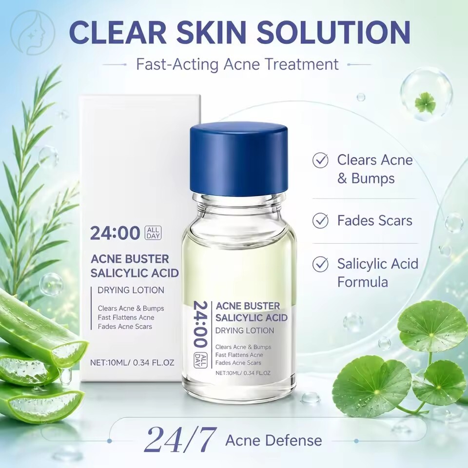 Acne Drying Lotion – Fast-Acting Salicylic Acid Spot Treatment